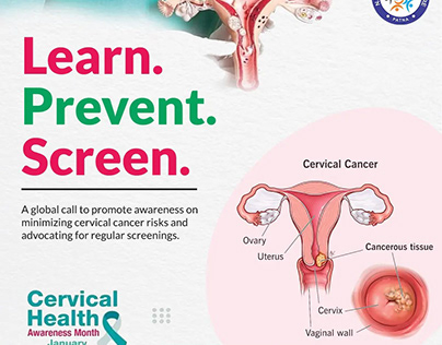 Cervical Cancer: Cancer Treatment Centre in Patna!