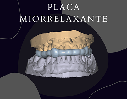 Placa Miorrelaxante