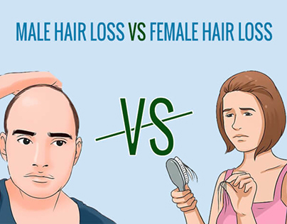 Male Hair Loss VS Female Hair Loss