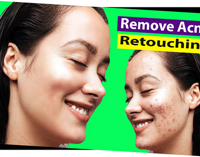 Retouch | Remove face spot | pimple