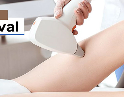 Laser Hair Removal Treatment Clinic in Gurgaon