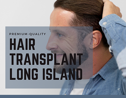 Premium-quality Hair Transplant Long Island