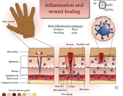 Skin inflammation and wound healing