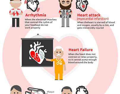 Know the Heart Conditions