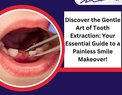 Discover the Gentle Art of Tooth Extraction
