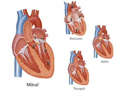 Human Heart Illustrations with Workers
