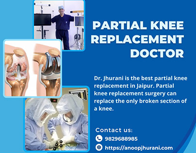 Dr. Anoop Jhurani for partial knee replacement?