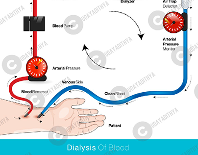 dialysis science vector illustration