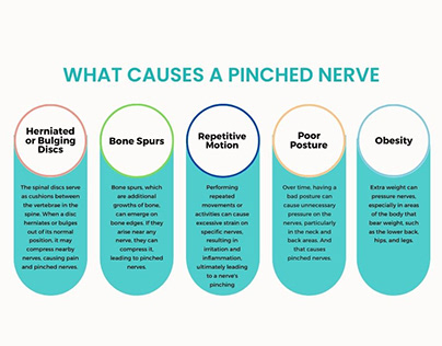 What Causes Pinched Nerves Chiropractor