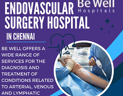 Endovascular Surgery Hospital in Chennai
