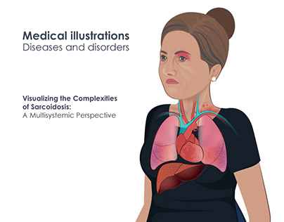 Medical Illustration | Diseases and Disorders
