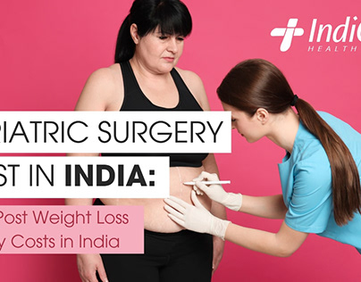 Bariatric Surgery in India | IndiCure Health Tours