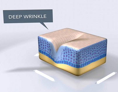 Anti-Wrinkle Patch