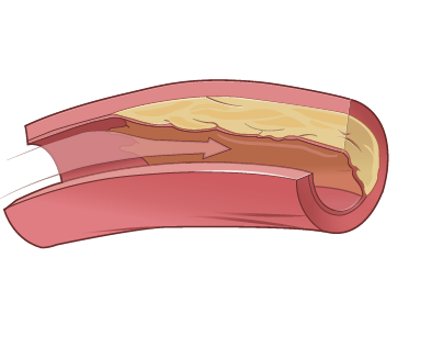 Human Organ Illustration