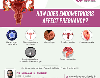 HOW DOES ENDOMETRIOSIS AFFECT PREGNANCY?