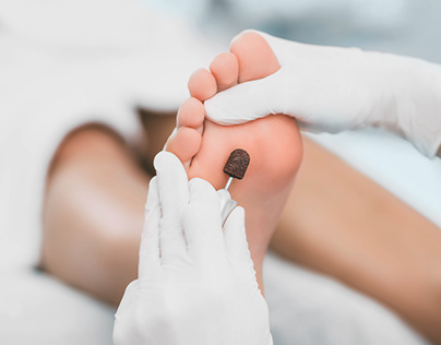 How to Treat and Prevent the Toenail and Foot Fungal