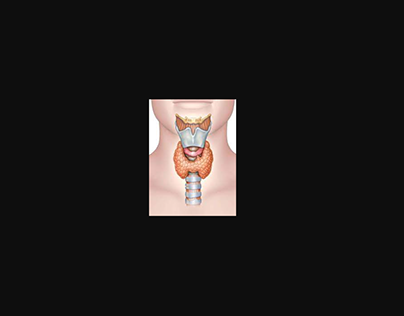 Thyroid Treatment Ambur | KM NU Hospitals