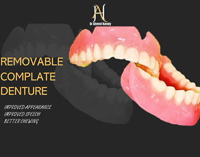 Removable complate denture