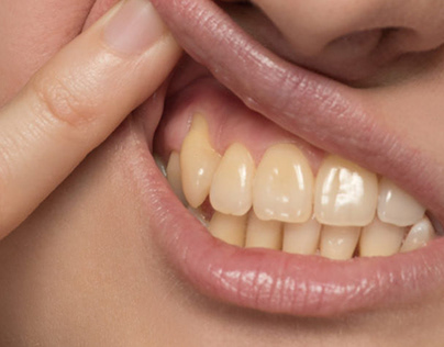 Home Remedies to get rid of yellow teeth
