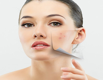 Effective Pimple Treatments for Clear Skin
