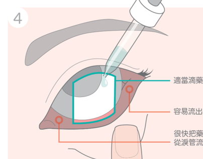How to Use Eye Drops Properly - Instruction Design