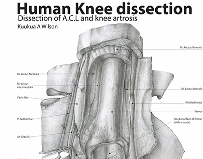 Knee and ACL dissection