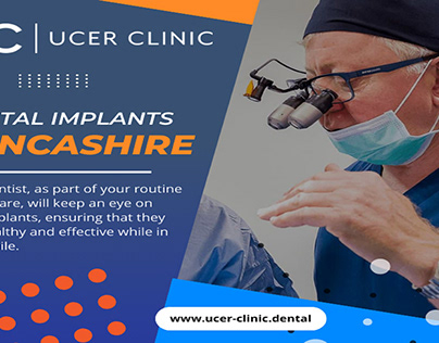 Dental Implants Lancashire