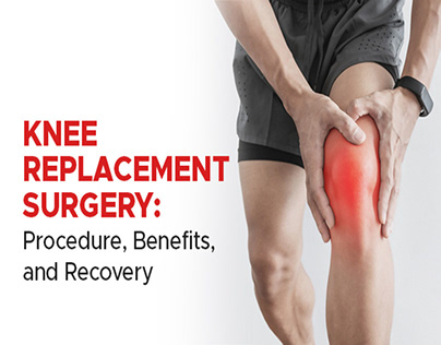 Knee Replacement Surgery at Gadge Hospital Nagpur