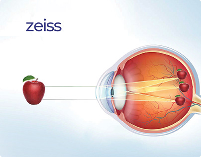 Zeiss - Android Application