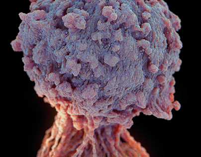 Tumor Cell Render test