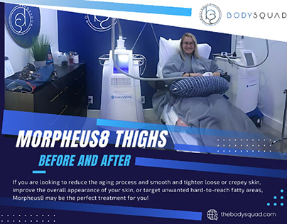 Morpheus8 Thighs Before and After