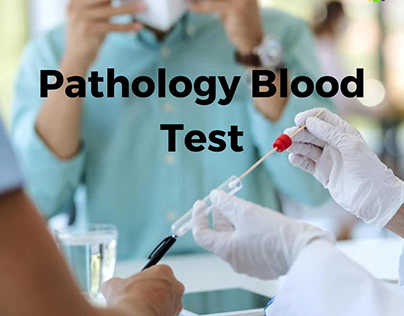 Get pathology blood test in Uk | Diagnostics360