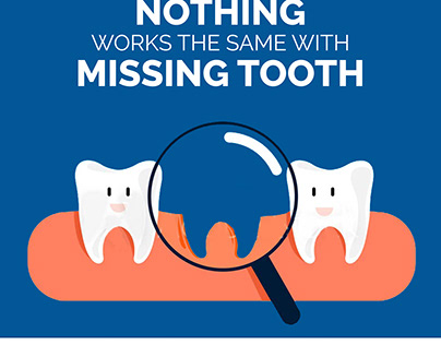 Nothing works the same with missing tooth.