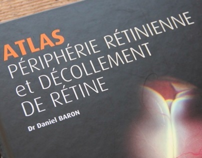 Atlas d'ophtalmologie