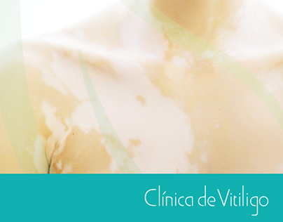 Clínica de Vitiligo