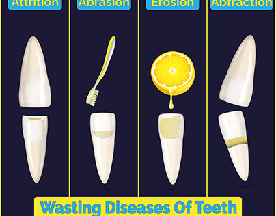 Dentity : wasting diseases