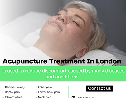 Western Medical Acupuncture Treatment in London