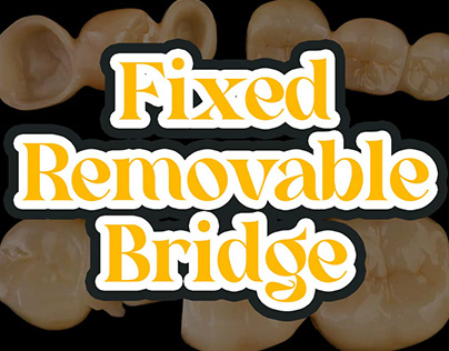 Fixed Removable Bridge