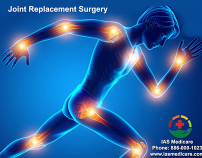 Best Joint Replacement Surgery Hospital in Gurugram