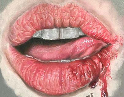 Bleeding lips
