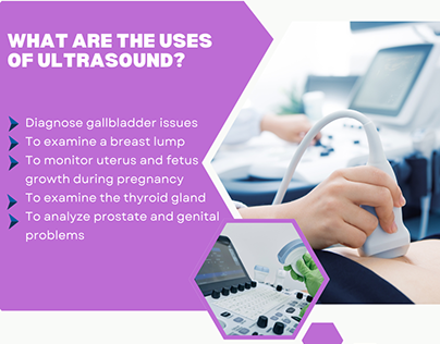 What is an ultrasound used for?