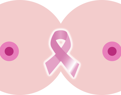 Folleto cancer de mama / Brochure on breast cancer