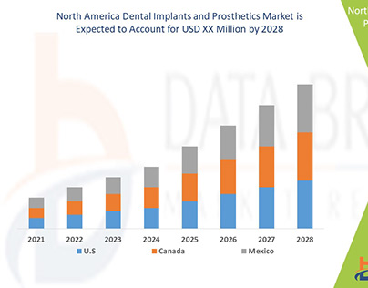 North America Dental Implants and Prosthetics Market
