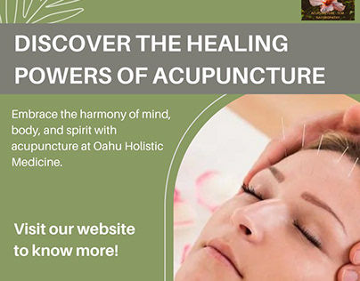 Discover the Healing Powers of Acupuncture in Kailua