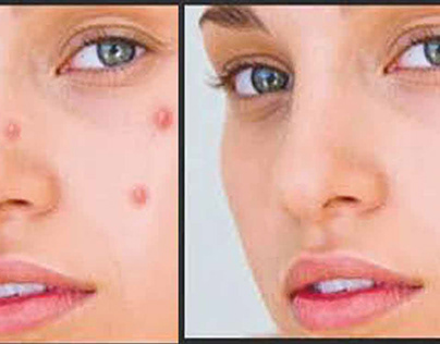 scars removal and change image colour