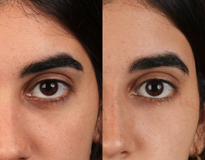 Before & After Reel: Dalia Derma Clinic