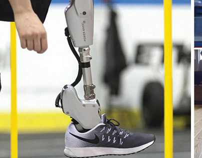 Powered Ankle Prosthesis Design