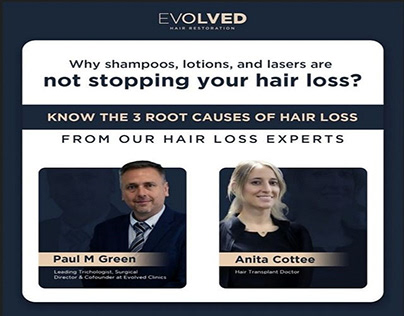 Consult Hair Loss Experts