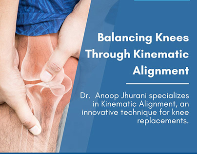 Balancing Knees Through Kinematic Alignment
