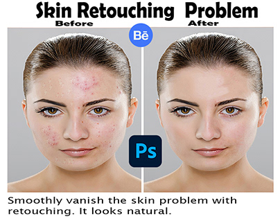 Skin Retouching, Beauty Retouch, Fashion & Spot Remove